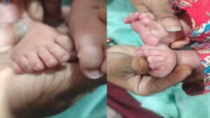 हिमाचल:पालमपुर में 24 अंगुलियों वाले अनोखे बच्चे ने लिया जन्म, डॉक्टर ने ये बताई वजह – Himachal: Unique Baby With 24 Fingers Born In Palampur; Doctor Explains The Reason.